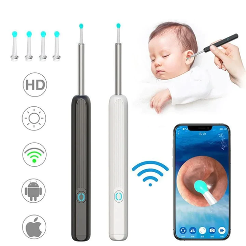 Clean Earwax-Wi-Fi Visible Wax Removal Spoon