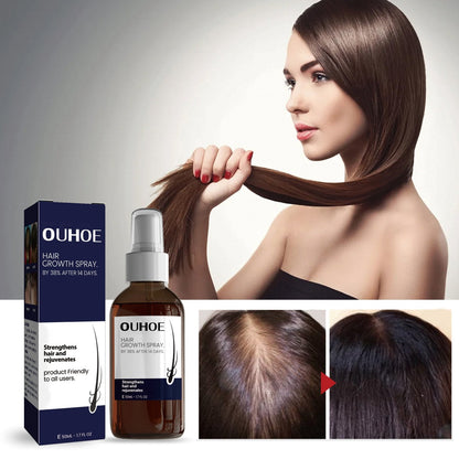 OUHOE Natural Hair Regrowth Spray