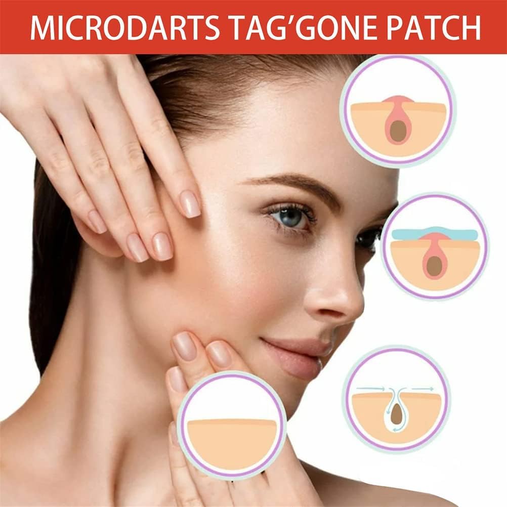 تصحيح TAG'Gone الخاص بلعبة MicroDarts