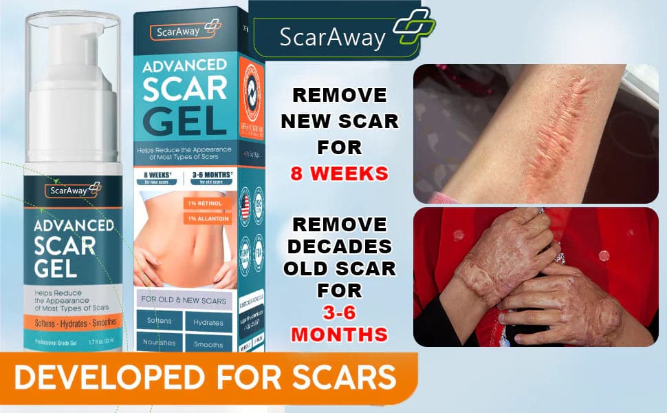 ScarAway®100% Advanced Scar Gel, cicatrices de cesárea, abdominoplastia, cicatrices antiguas, queloides, estrías, cicatrices de quemaduras.