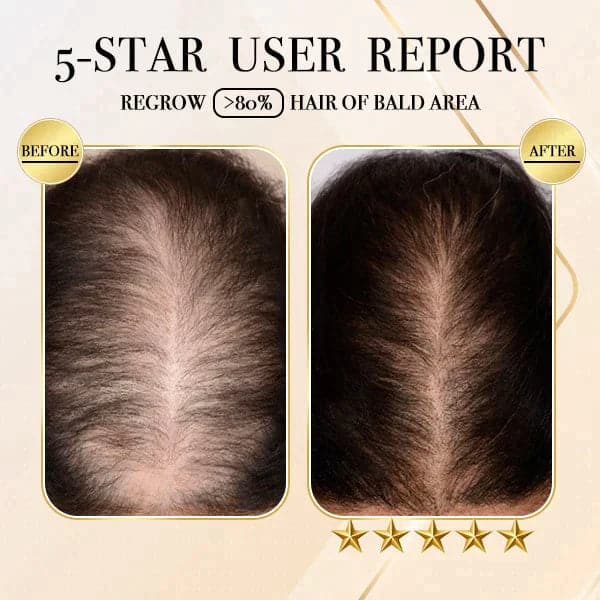 Barra de champú para el crecimiento del cabello procesado en frío con jengibre 1+1 (2 uds.)