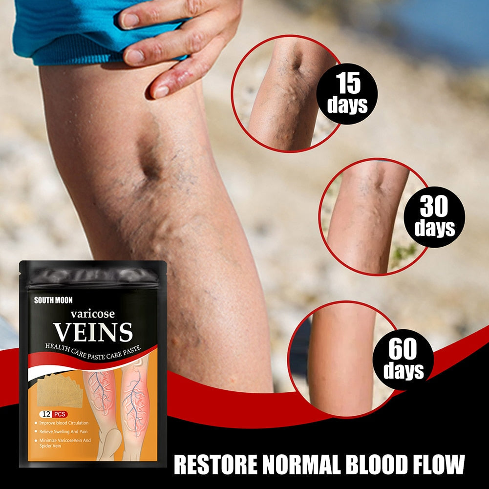 VeinHealth Varicose Veins Treatment Patch