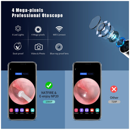 Smart Visual Ear Cleaner