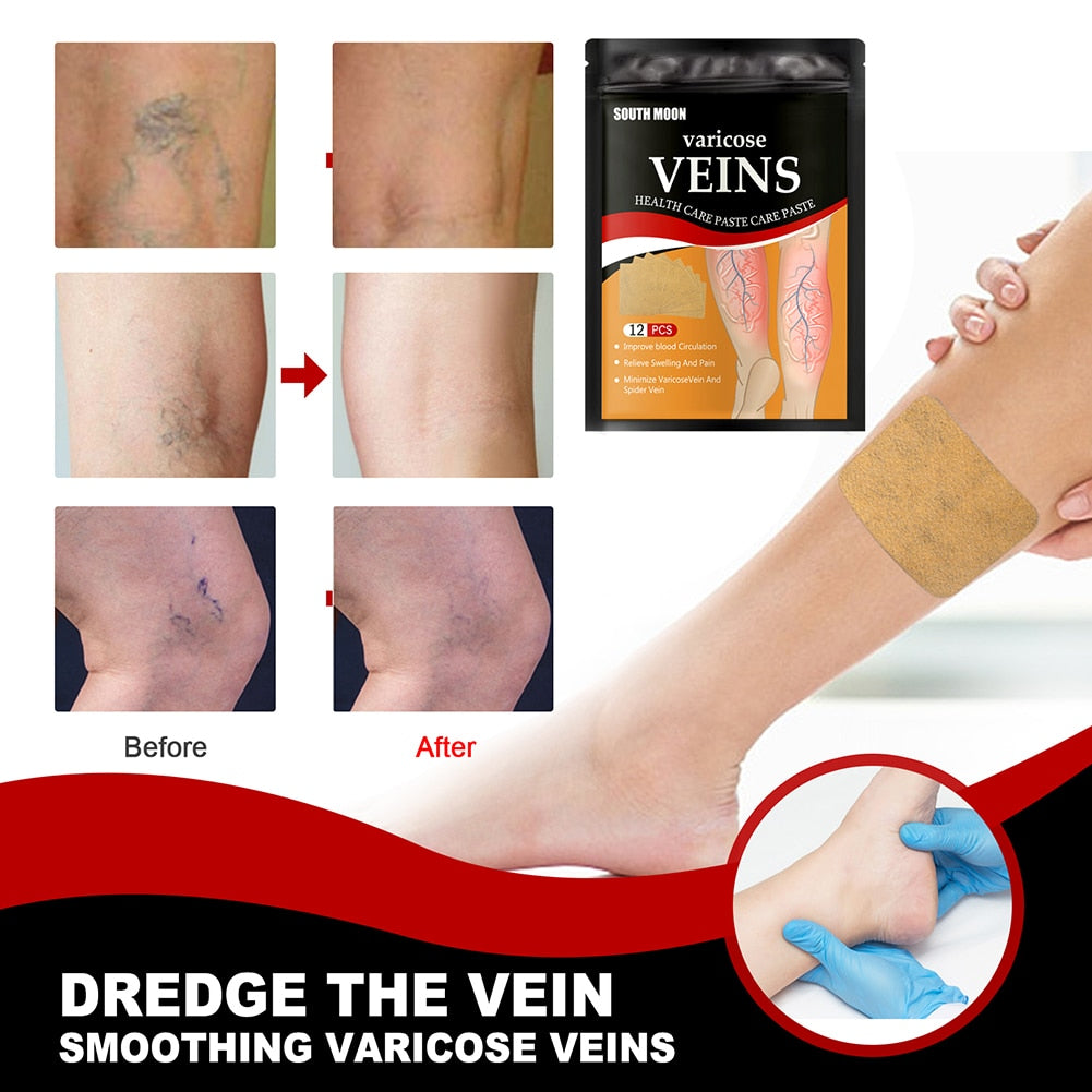 VeinHealth Varicose Veins Treatment Patch