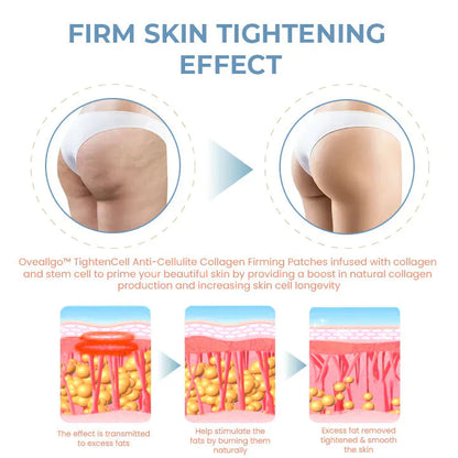 Oveallgo™ PRO TightenCell Anti-Cellulite Collagen Firming Patches