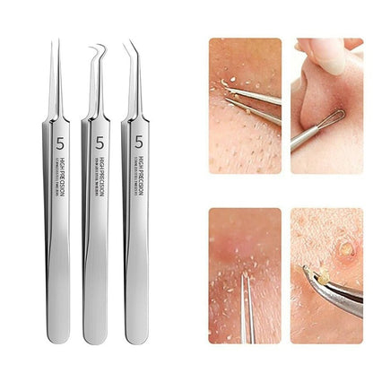 Blackhead Belle Skin Tool