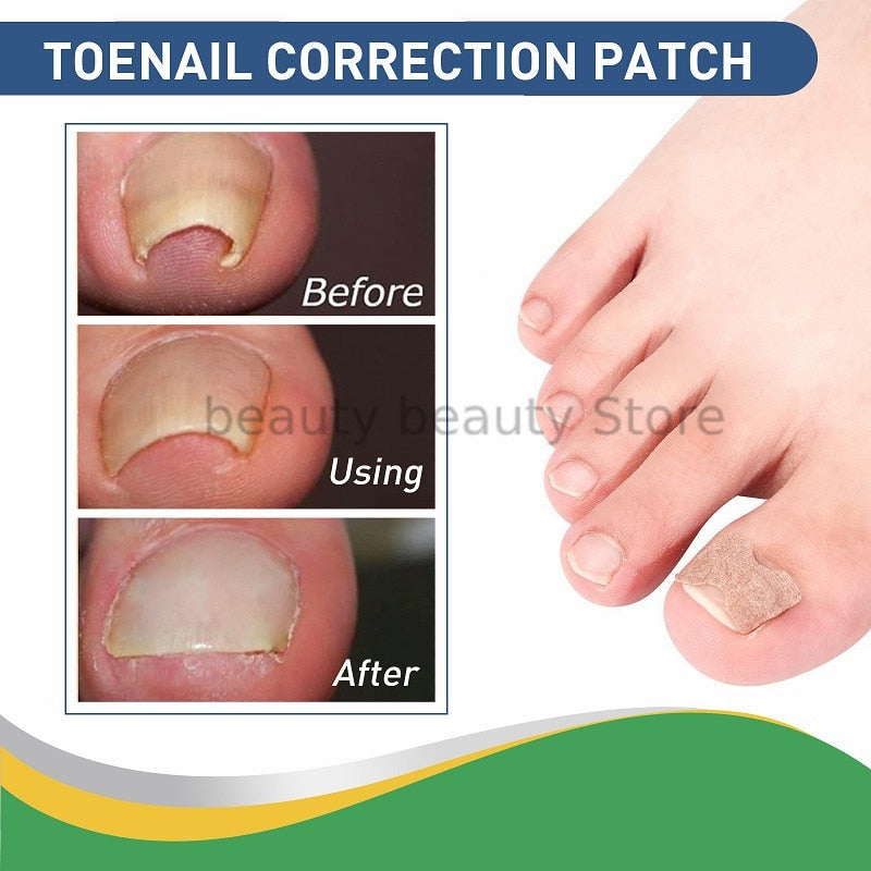 Toenail Savior Kit