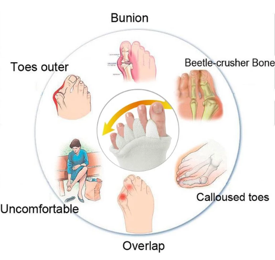 Bunion Relief Toe Socks