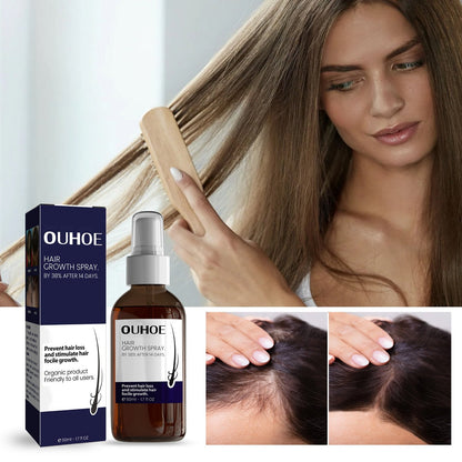 OUHOE Natural Hair Regrowth Spray