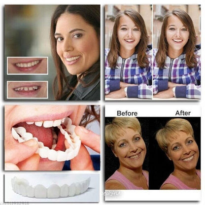 Adjustable Snap-On Denture