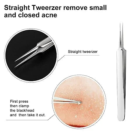 Professional Blackhead Remover