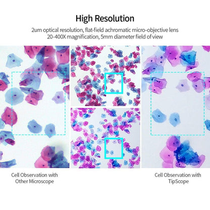 Mobile Phone Microscope