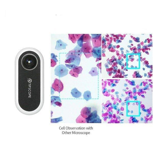 Mobile Phone Microscope