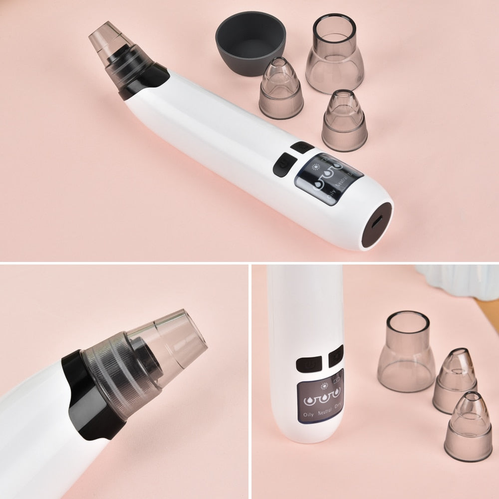 Blackhead Vacuum Suction