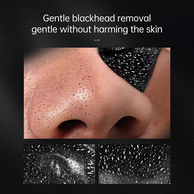 Blackhead Remover Masks