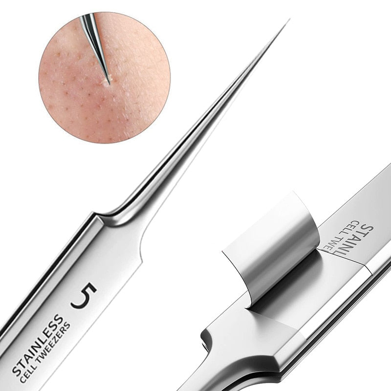 Blackhead Belle Skin Tool