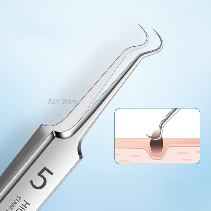 Blackhead Belle Skin Tool