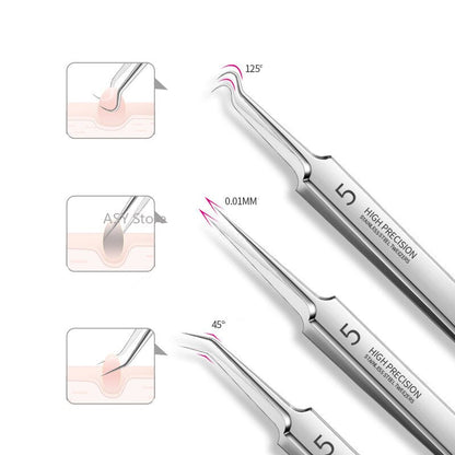 Blackhead Belle Skin Tool